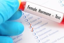 Female Hormone Testing